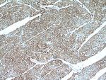 UBAP1 Antibody in Immunohistochemistry (Paraffin) (IHC (P))