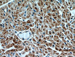 UBAP1 Antibody in Immunohistochemistry (Paraffin) (IHC (P))