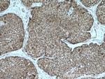 UBAP1 Antibody in Immunohistochemistry (Paraffin) (IHC (P))