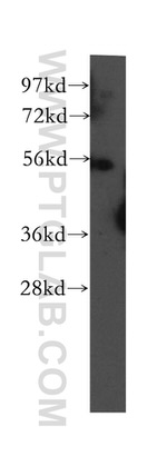 UBAP1 Antibody in Western Blot (WB)