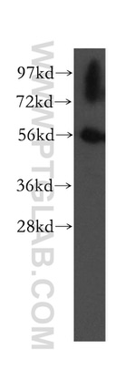 UBAP1 Antibody in Western Blot (WB)