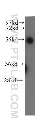 UBAP1 Antibody in Western Blot (WB)