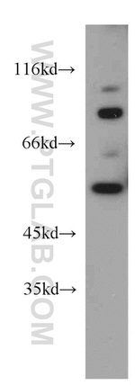 UBAP1 Antibody in Western Blot (WB)