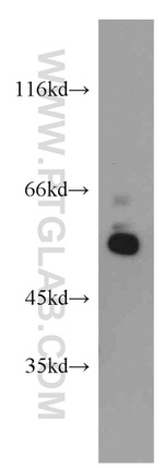 UBAP1 Antibody in Western Blot (WB)