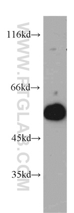 UBAP1 Antibody in Western Blot (WB)