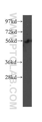 UBAP1 Antibody in Western Blot (WB)