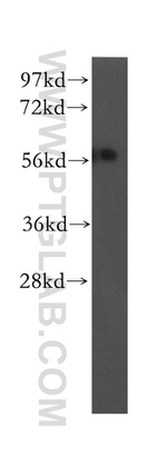 UBAP1 Antibody in Western Blot (WB)