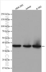 CA8 Antibody in Western Blot (WB)