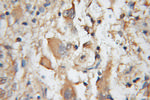 CA8 Antibody in Immunohistochemistry (Paraffin) (IHC (P))