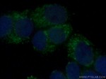 A4GALT Antibody in Immunocytochemistry (ICC/IF)