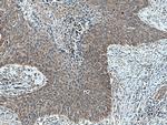 A4GALT Antibody in Immunohistochemistry (Paraffin) (IHC (P))