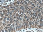 A4GALT Antibody in Immunohistochemistry (Paraffin) (IHC (P))