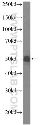 A4GALT Antibody in Western Blot (WB)