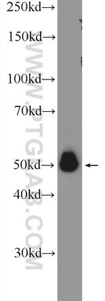 A4GALT Antibody in Western Blot (WB)