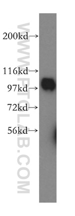 COPG Antibody in Western Blot (WB)