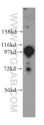 COPG Antibody in Western Blot (WB)