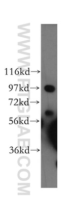 COPG Antibody in Western Blot (WB)