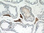 UNG Antibody in Immunohistochemistry (Paraffin) (IHC (P))