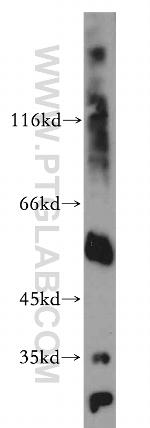 UNG Antibody in Western Blot (WB)