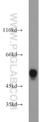 MAT1A Antibody in Western Blot (WB)