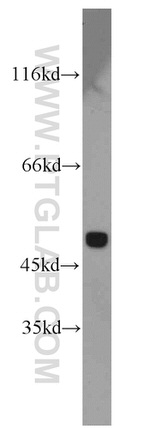 MAT1A Antibody in Western Blot (WB)