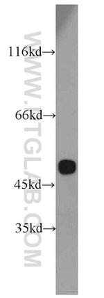 MAT1A Antibody in Western Blot (WB)