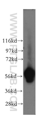 LBR Antibody in Western Blot (WB)