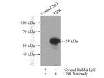 LBR Antibody in Immunoprecipitation (IP)