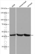 TPST1 Antibody in Western Blot (WB)