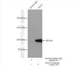 Aconitase 1 Antibody in Immunoprecipitation (IP)