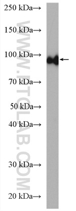 Aconitase 1 Antibody in Western Blot (WB)