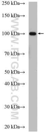 Aconitase 1 Antibody in Western Blot (WB)