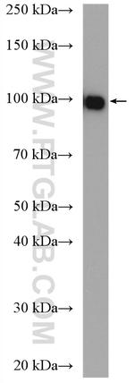 Aconitase 1 Antibody in Western Blot (WB)