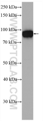 Aconitase 1 Antibody in Western Blot (WB)