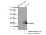 SGCE Antibody in Immunoprecipitation (IP)