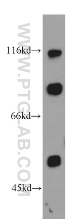 SGCE Antibody in Western Blot (WB)