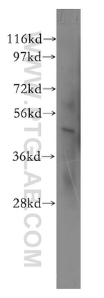 SGCE Antibody in Western Blot (WB)