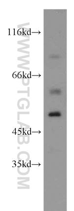 SGCE Antibody in Western Blot (WB)