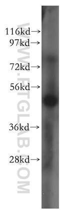 SGCE Antibody in Western Blot (WB)