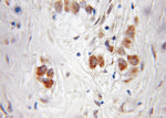 PI4KA Antibody in Immunohistochemistry (Paraffin) (IHC (P))