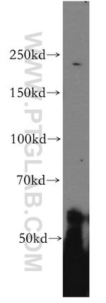 PI4KA Antibody in Western Blot (WB)