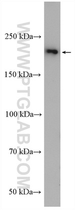 PI4KA Antibody in Western Blot (WB)