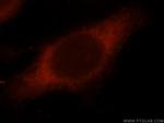 PDCD6IP Antibody in Immunocytochemistry (ICC/IF)