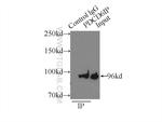 PDCD6IP Antibody in Immunoprecipitation (IP)