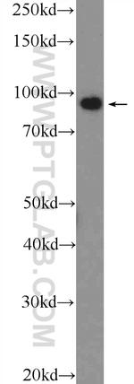 PDCD6IP Antibody in Western Blot (WB)