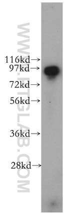 PDCD6IP Antibody in Western Blot (WB)