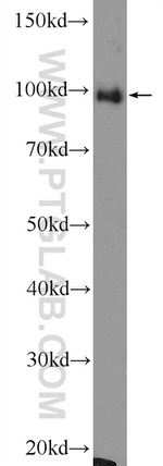 PDCD6IP Antibody in Western Blot (WB)