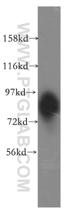 SLC20A1 Antibody in Western Blot (WB)