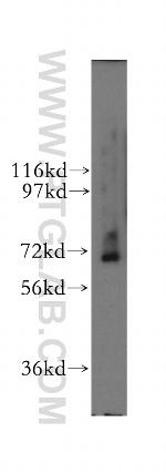 RNGTT Antibody in Western Blot (WB)