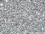 MYO9B Antibody in Immunohistochemistry (Paraffin) (IHC (P))